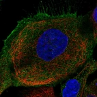 Immunofluorescent staining of human cell line A-431 shows localization to plasma membrane & cytosol.