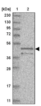 Lane 1: Marker [kDa] 230, 130, 95, 72, 56, 36, 28, 17, 11_br/_Lane 2: Human cell line RT-4