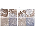 Anti-MRPL18 Antibody