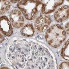 Immunohistochemical staining of human kidney using Anti-MRPL18 antibody HPA028774.