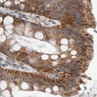 Immunohistochemical staining of human colon using Anti-MRPL18 antibody HPA028774.