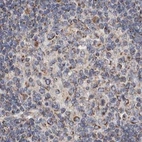 Immunohistochemical staining of human lymph node using Anti-MRPL18 antibody HPA028774.