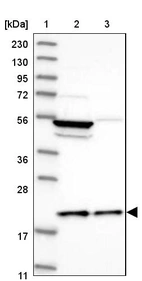 Lane 1: Marker [kDa] 230, 130, 95, 72, 56, 36, 28, 17, 11_br/_Lane 2: Human cell line RT-4_br/_Lane 3: Human cell line U-251MG sp