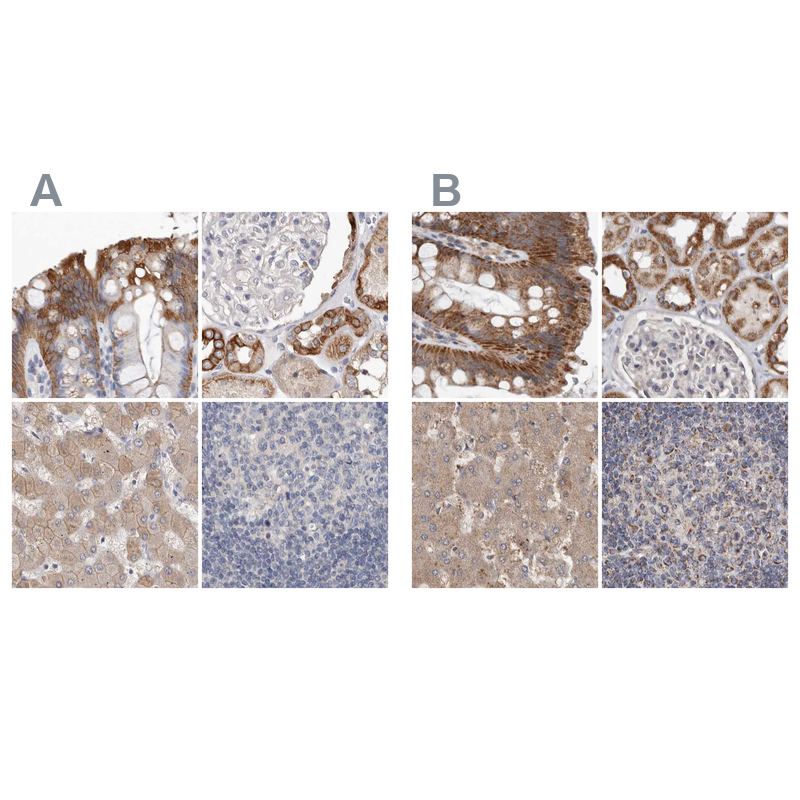 Anti-MRPL18 Antibody