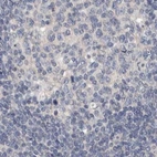 Immunohistochemical staining of human lymph node using Anti-MRPL18 antibody HPA028775.