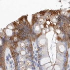 Immunohistochemical staining of human colon using Anti-MRPL18 antibody HPA028775.