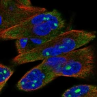 Immunofluorescent staining of human cell line RH-30 shows localization to nucleoli & cytosol.
