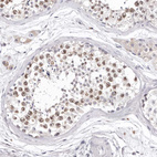 Immunohistochemical staining of human testis shows moderate nuclear positivity in cells in seminiferous ducts.
