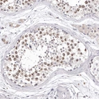 Immunohistochemical staining of human testis shows moderate nuclear positivity in cells in seminiferous ducts.