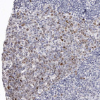 Immunohistochemical staining of human lymph node shows moderate nuclear positivity in subset of germinal center cells.