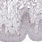 Immunohistochemical staining of human skin shows moderate nuclear positivity in subset of squamous epithelial cells.