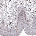 Immunohistochemical staining of human skin shows moderate nuclear positivity in subset of squamous epithelial cells.