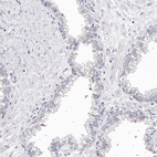 Immunohistochemical staining of human prostate shows no positivity in glandular cells as expected.