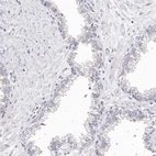 Immunohistochemical staining of human prostate shows no positivity in glandular cells as expected.