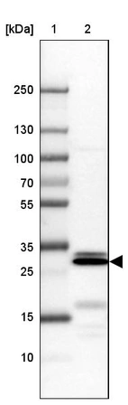 Lane 1: Marker [kDa] 250, 130, 100, 70, 55, 35, 25, 15, 10_br/_Lane 2: Human cell line U-251 MG