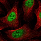 Immunofluorescent staining of human cell line U-2 OS shows localization to nucleoplasm.