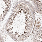 Anti-LCORL Antibody