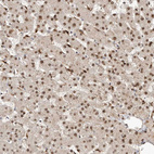 Immunohistochemical staining of human Liver shows strong nuclear positivity in hepatocytes.