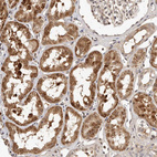 Immunohistochemical staining of human Kidney shows moderate nuclear positivity in cells in tubules.