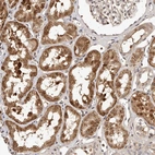 Immunohistochemical staining of human Kidney shows moderate nuclear positivity in cells in tubules.