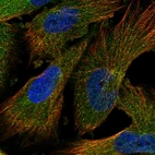 Immunofluorescent staining of human cell line U-251 MG shows localization to cytosol.