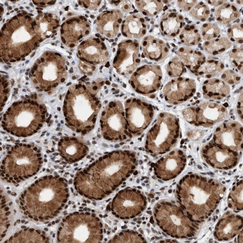 Anti-ZNF260 Antibody