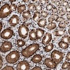 Anti-ZNF260 Antibody