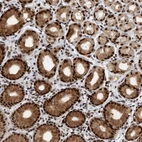 Anti-ZNF260 Antibody