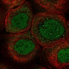 Immunofluorescent staining of human cell line A-431 shows localization to nucleoplasm & cytosol.