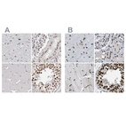 Immunohistochemical staining of human cerebral cortex, kidney, skeletal muscle and testis using Anti-SCAF4 antibody HPA028807 (A) shows similar protein distribution across tissues to independent antibody HPA018319 (B).