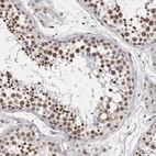 Immunohistochemical staining of human testis shows high expression.
