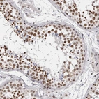 Immunohistochemical staining of human testis shows high expression.
