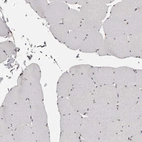 Immunohistochemical staining of human skeletal muscle shows low expression as expected.