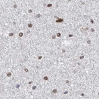 Immunohistochemical staining of human cerebral cortex using Anti-SCAF4 antibody HPA028807.