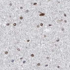 Immunohistochemical staining of human cerebral cortex using Anti-SCAF4 antibody HPA028807.