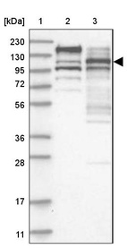 Lane 1: Marker [kDa] 230, 130, 95, 72, 56, 36, 28, 17, 11_br/_Lane 2: Human cell line RT-4_br/_Lane 3: Human cell line U-251MG sp