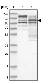 Lane 1: Marker [kDa] 230, 130, 95, 72, 56, 36, 28, 17, 11_br/_Lane 2: Human cell line RT-4_br/_Lane 3: Human cell line U-251MG sp