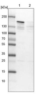 Lane 1: NIH-3T3 cell lysate (Mouse embryonic fibroblast cells)_br/_Lane 2: NBT-II cell lysate (Rat Wistar bladder tumour cells)