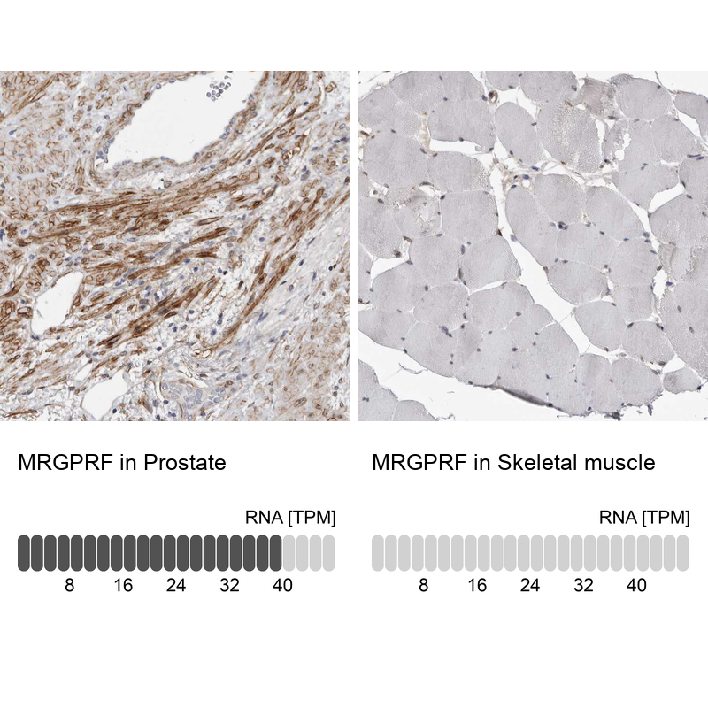 Anti-MRGPRF Antibody