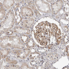 Anti-MRGPRF Antibody