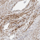 Immunohistochemical staining of human prostate shows moderate membranous positivity in smooth muscle cells.