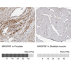 Immunohistochemistry analysis in human prostate and skeletal muscle tissues using HPA028811 antibody. Corresponding MRGPRF RNA-seq data are presented for the same tissues.