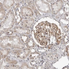 Immunohistochemical staining of human kidney shows moderate membranous positivity in cells in glomeruli.