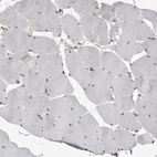 Immunohistochemical staining of human skeletal muscle shows no positivity in myocytes as expected.