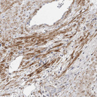 Immunohistochemical staining of human prostate shows moderate membranous positivity in smooth muscle cells.