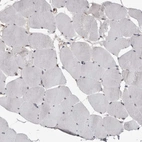 Immunohistochemical staining of human skeletal muscle shows no positivity in myocytes as expected.