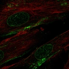 Immunofluorescent staining of human cell line BJ shows localization to nuclear membrane & plasma membrane.