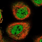 Immunofluorescent staining of human cell line A-431 shows localization to nucleoplasm & cytosol.