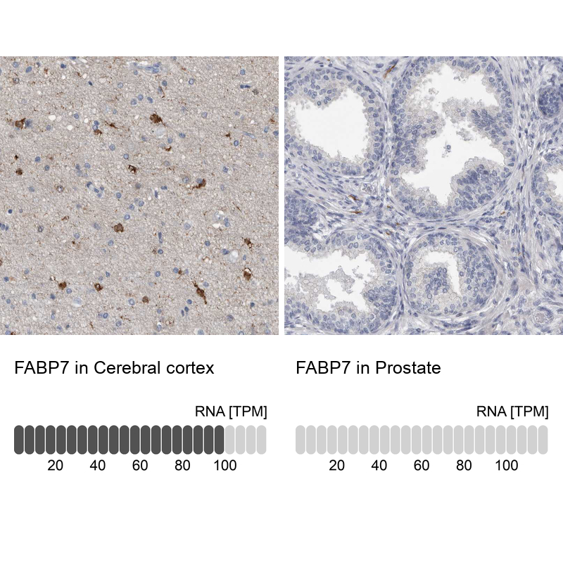 Anti-FABP7 Antibody