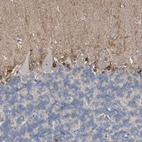 Immunohistochemical staining of human cerebellum shows strong cytoplasmic positivity in Bergmann glia.